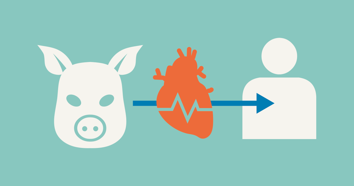 Man Receives Pig's Heart ESL Library